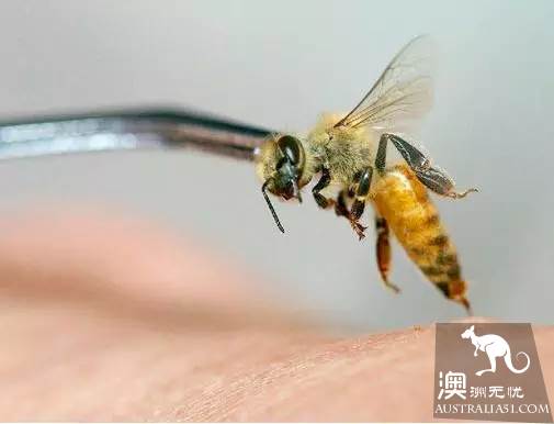 太毒了!澳洲男修剪草坪时,突然浑身肿胀命丧黄泉!我们后院里竟暗藏澳洲第一杀手!