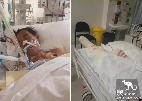 太毒了!澳洲男修剪草坪时,突然浑身肿胀命丧黄泉!我们后院里竟暗藏澳洲第一杀手!