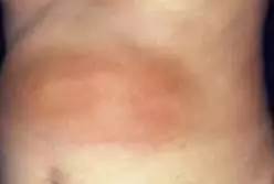 太毒了!澳洲男修剪草坪时,突然浑身肿胀命丧黄泉!我们后院里竟暗藏澳洲第一杀手!