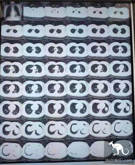 武漢疫區日記:和妻兒生死別離的 28 天