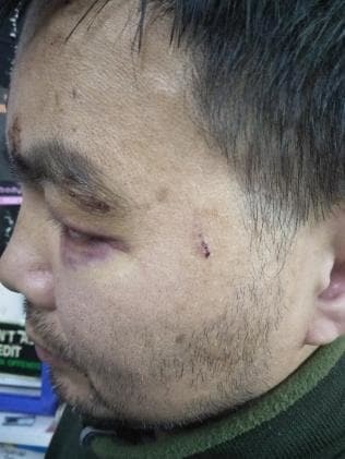 又有澳洲华裔店主遭持械抢劫，枪托砸头伤口骇人！华人商家成目标？每月一伤！