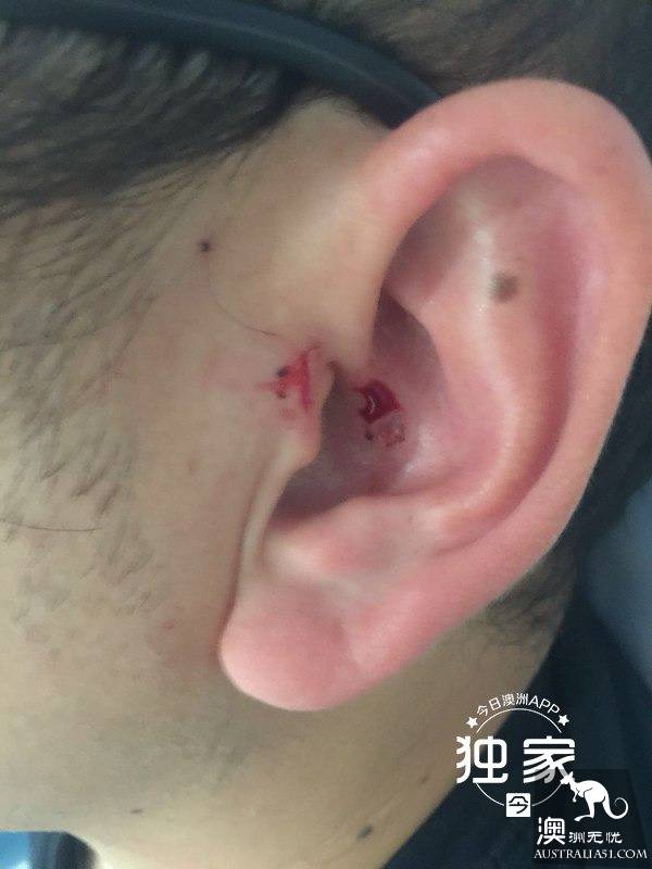 “他们叫嚣捅死我们、强奸我，还想烧店！”卧龙岗华人及留学生成袭击目标，频遭殴抢，多人受伤！